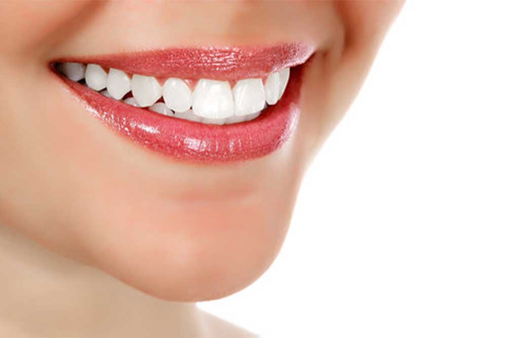 يعد تبييض الأسنان إحدى الطرق المهمة لاستعادة الأسنان الصفراء والمغطاة بالبلاك، والتي يتم إجراؤها في عيادة الدكتور عماد زاده
